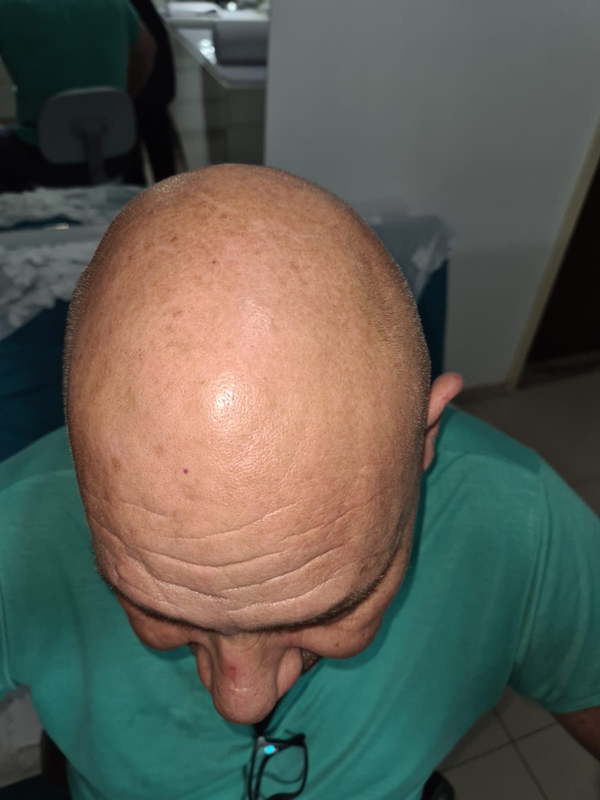 Micropigmentação em Campo Grande MS